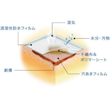 [一般医療機器]業務用モイスキンパッド(滅菌済)　各種の画像